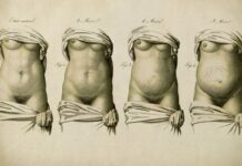 Diastasis Recti Post Birth: What to Look For, What to Do