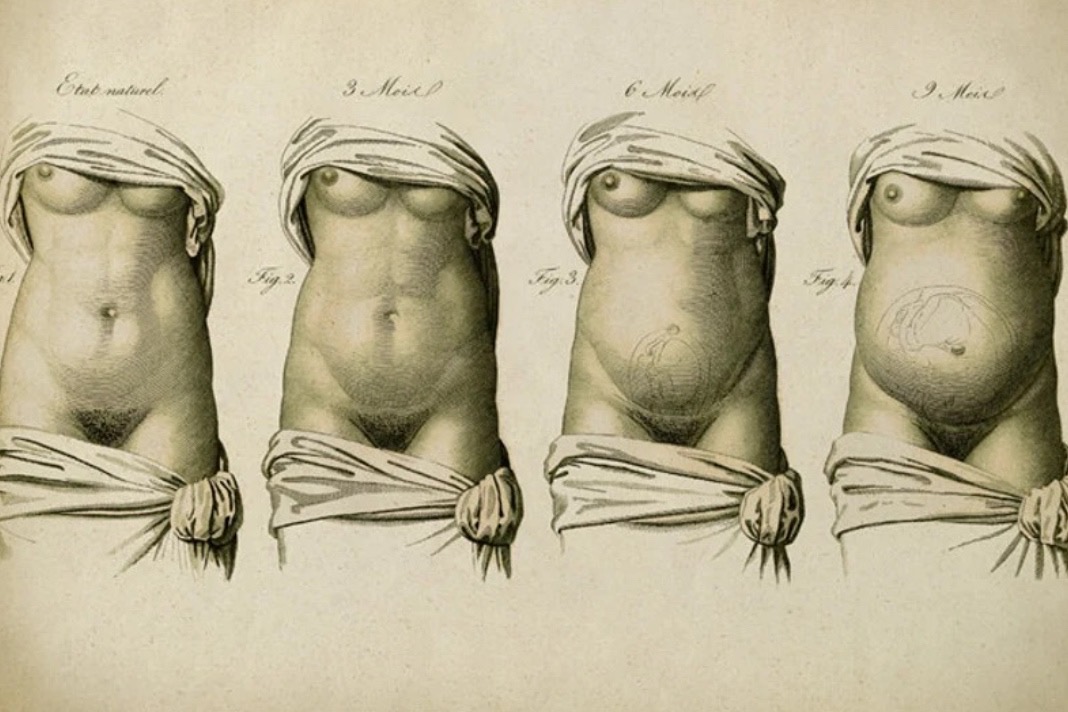 Diastasis Recti Post Birth: What to Look For, What to Do - Carolyn